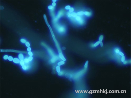 MHF100荧光显微镜下观察的皮肤真菌1 广州明慧显微