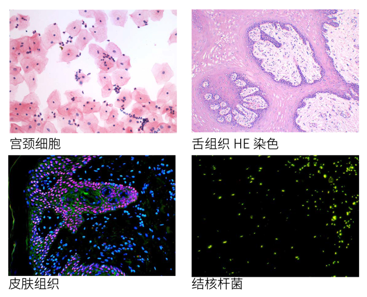 fish荧光显微镜、免疫荧光显微镜、广州明慧显微镜