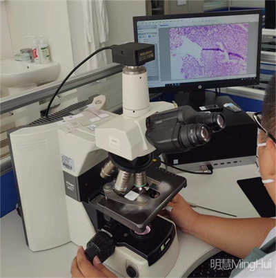 明慧显微镜摄像头MHD2000助力病理学研究：从感染性疾病到肿瘤精准诊断的突破