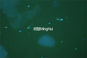 明慧荧光模块和显微镜相机助力广州某医院用于检测白带