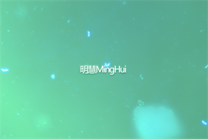 明慧荧光模块和显微镜相机助力广州某医院用于检测白带