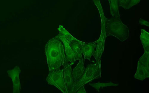 根据染料的激发和发射光谱怎么确定显微镜的激发光