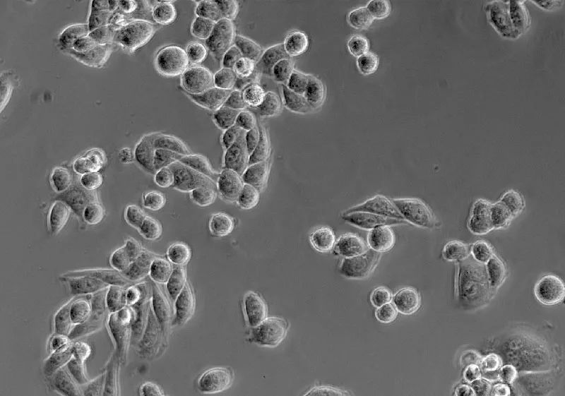 相衬观察（海拉细胞）