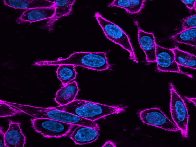 四通道LED荧光光源MH-400-LED荧光效果1