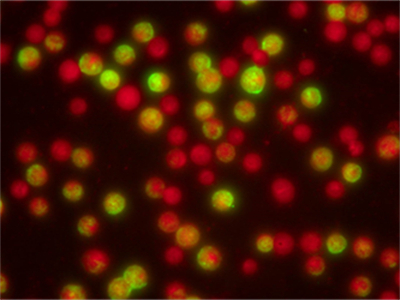 呼吸道病毒九联检