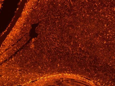 正置八孔LED荧光附件FL8-BGU-MH (2)