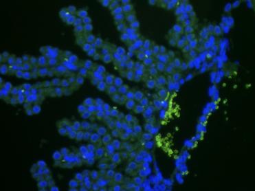 明慧电动倒置荧光附件应用效果图 (2)