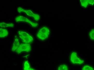明慧电动倒置荧光附件应用效果图 (3)
