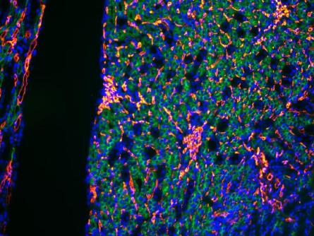 正置八孔LED荧光附件FL8-BGU-MH (1)