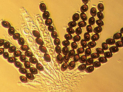 霍夫曼调制相衬NIB600