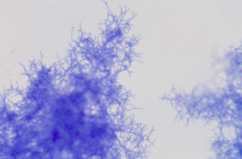 生物显微镜MHL3000明场观察效果 - 放线菌
