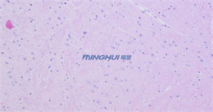 显微镜摄像头MHD2000适配奥林巴斯BX51升级用于病理诊断拍摄