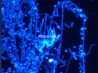 明慧UB203i-FL真菌荧光显微镜+MHD600显微相机实拍效果图