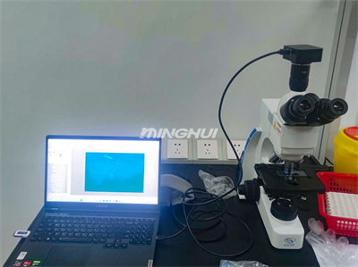真菌荧光显微镜系统UB203i-FL和MHD600助力湖南某医院真菌检测 真菌荧光显微镜系统UB203i-FL和MHD600助力湖南某医院真菌检测