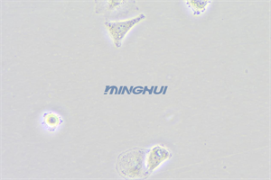 倒置显微镜MHIL200和MHD600相机应用于食管鳞癌观察（中山大学）