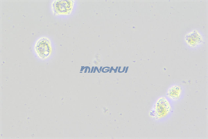 倒置显微镜MHIL200和MHD600相机应用于食管鳞癌观察（中山大学）