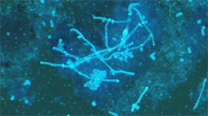 明慧荧光显微镜助力广西自贸区医院用于真菌荧光观察 明慧荧光显微镜助力广西自贸区医院用于真菌荧光观察