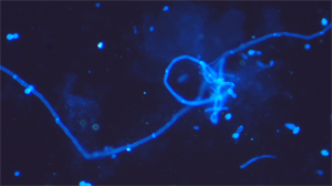 明慧荧光显微镜助力广西自贸区医院用于真菌荧光观察 明慧荧光显微镜助力广西自贸区医院用于真菌荧光观察