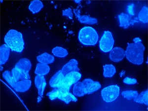 荧光显微镜UB203i-FL应用于皮肤科真菌观察