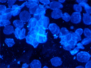 真菌荧光显微镜UB203i-FL搭配显微镜相机MHD500-2走进河南某知名医院