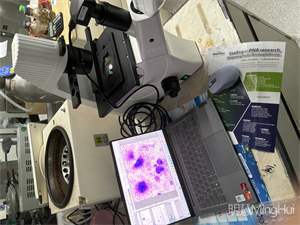 明慧MHIL150倒置显微镜和MHD1200显微镜摄像头应用于观察活体细胞
