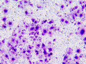 明慧MHIL150倒置显微镜和MHD1200显微镜摄像头应用于观察活体细胞