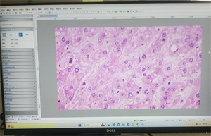 明慧显微镜相机MHD2000应用奥林巴斯显微镜BX43