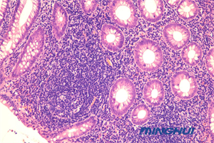 生物显微镜NE710+ MHD2000用于医院病理检验3.jpg