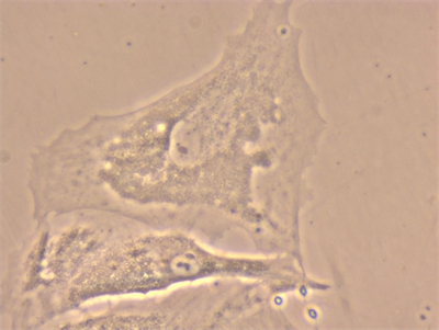 明慧NIB610倒置显微镜应用于细胞培养观察