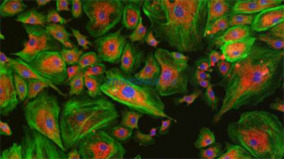 倒置荧光显微镜MHIF2000-荧光1.jpg 倒置荧光显微镜MHIF2000-荧光1.jpg