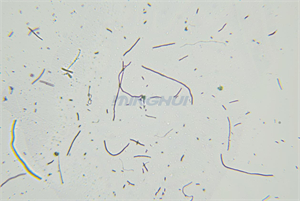 MHL2800生物显微镜和MHD2000高清显微镜摄像头用于红色短杆菌检测-实拍效果图1.jpg